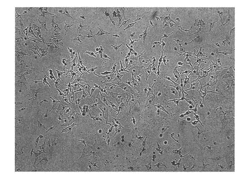 Preparation method and application of coating carrier system for vitiligo melanocyte transplantation