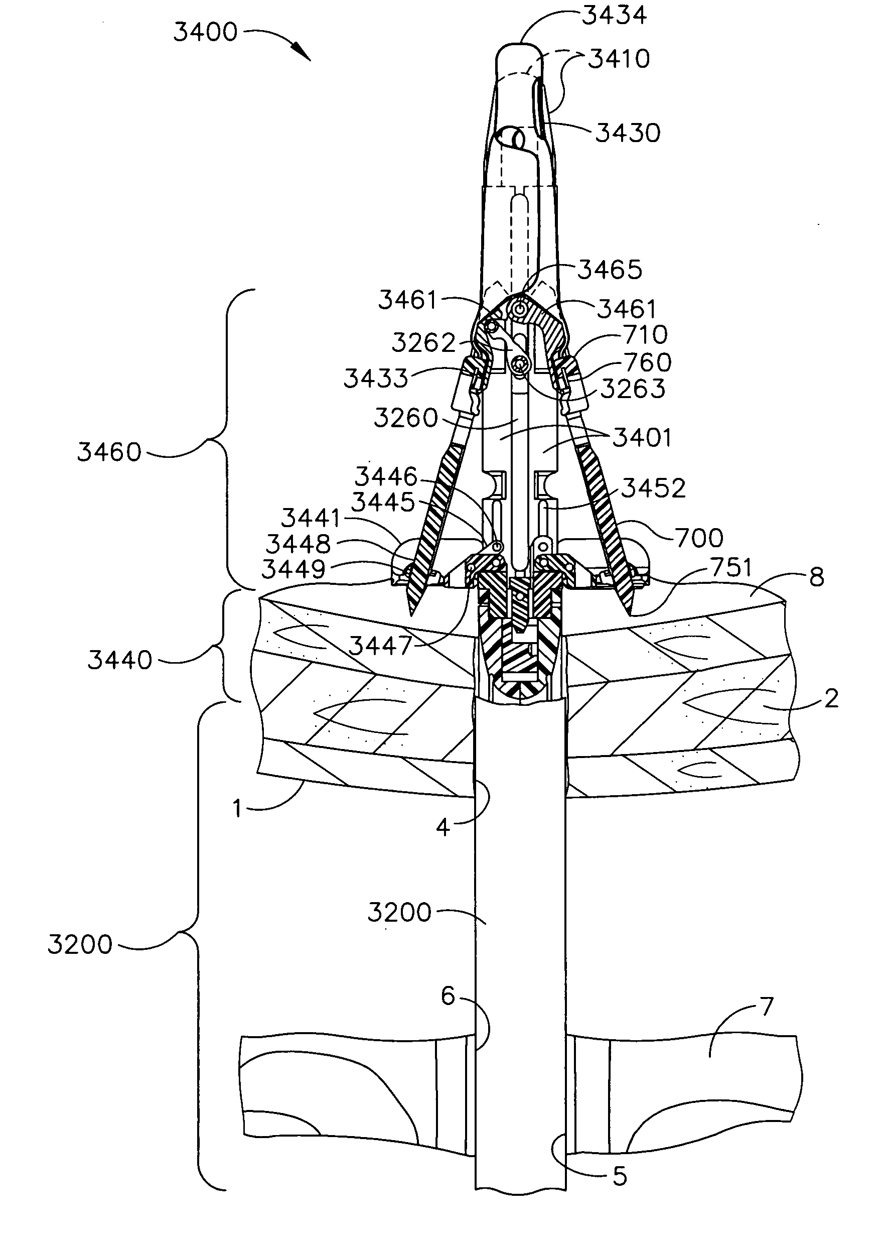 Anchors for use in anastomotic procedures