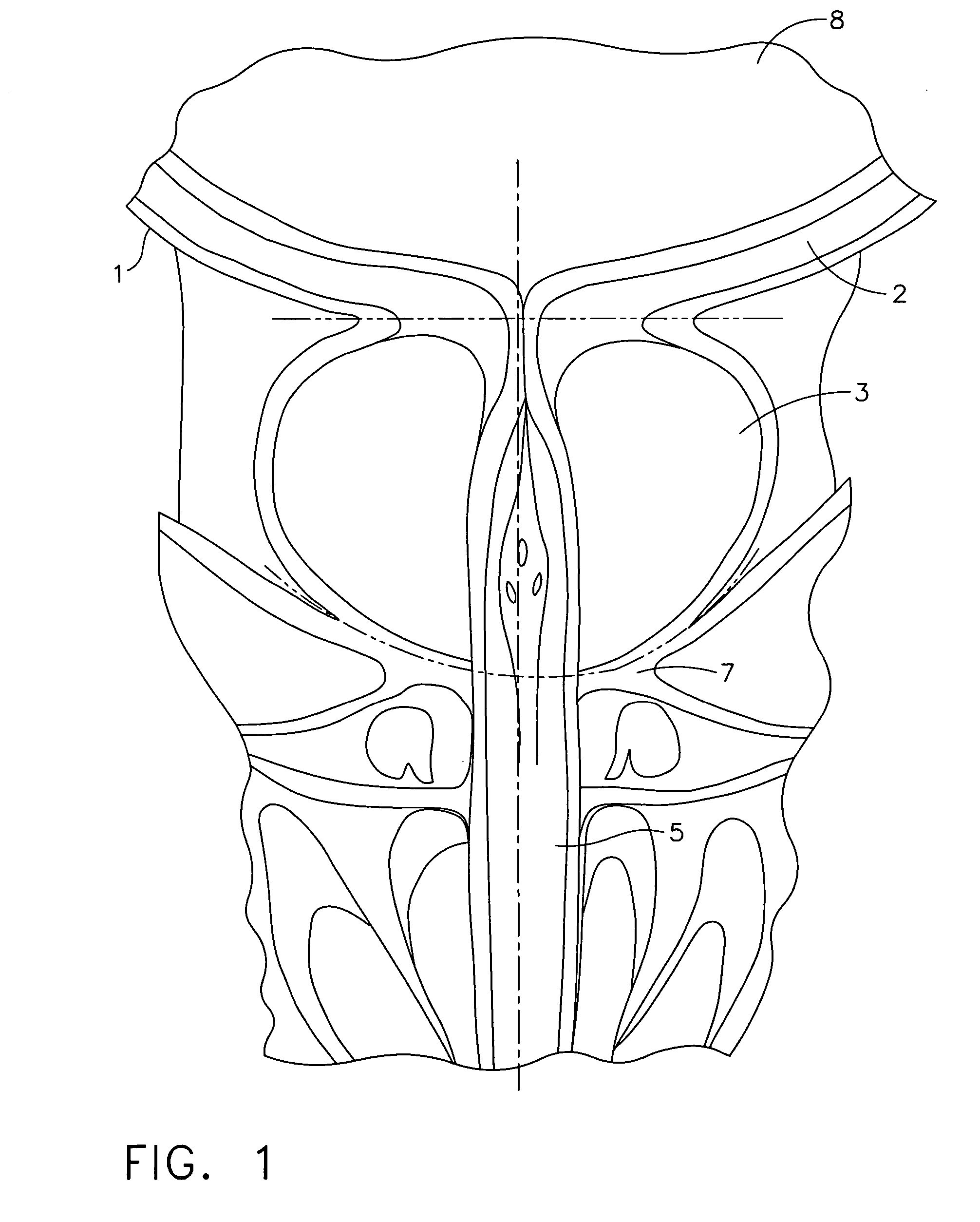 Anchors for use in anastomotic procedures