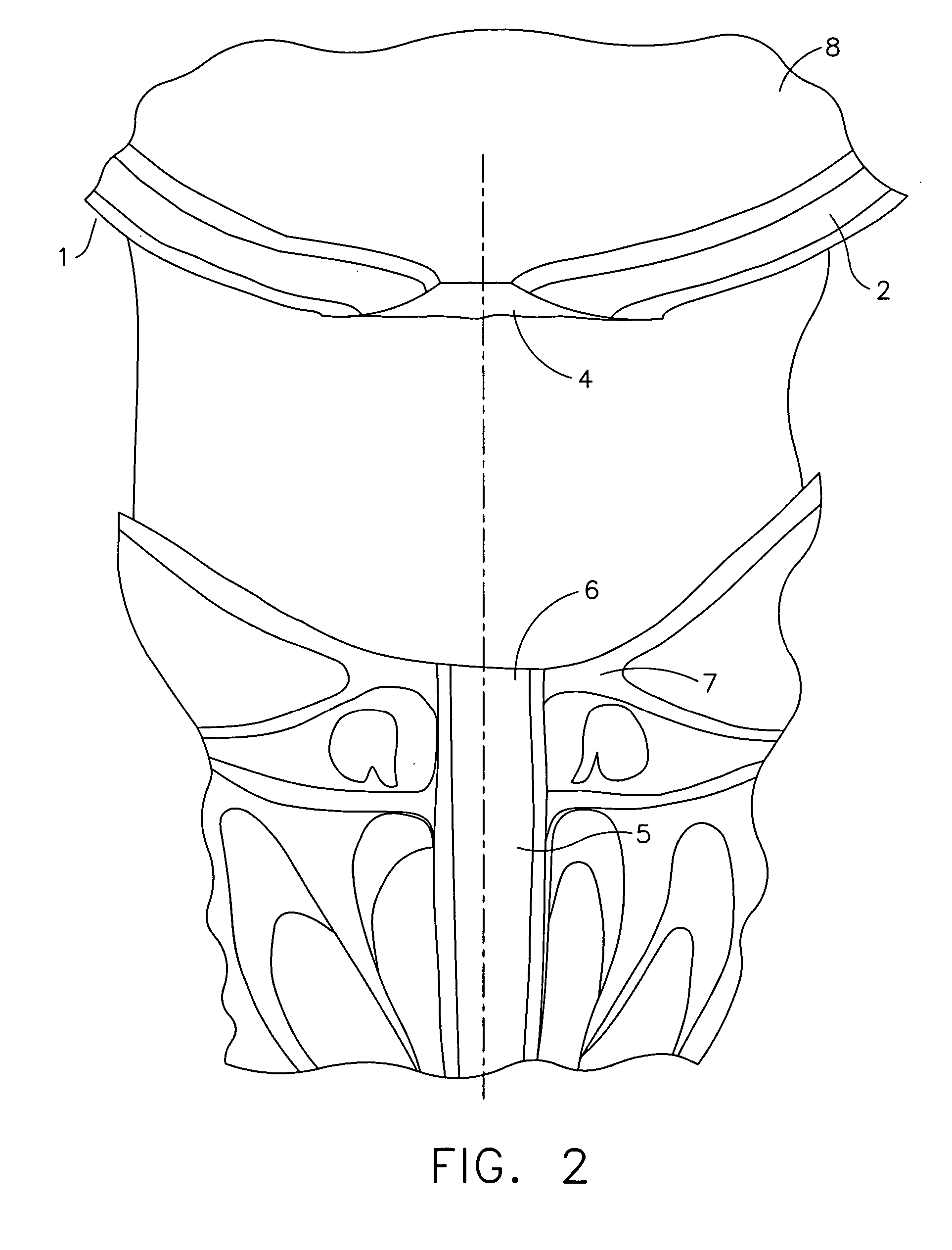 Anchors for use in anastomotic procedures