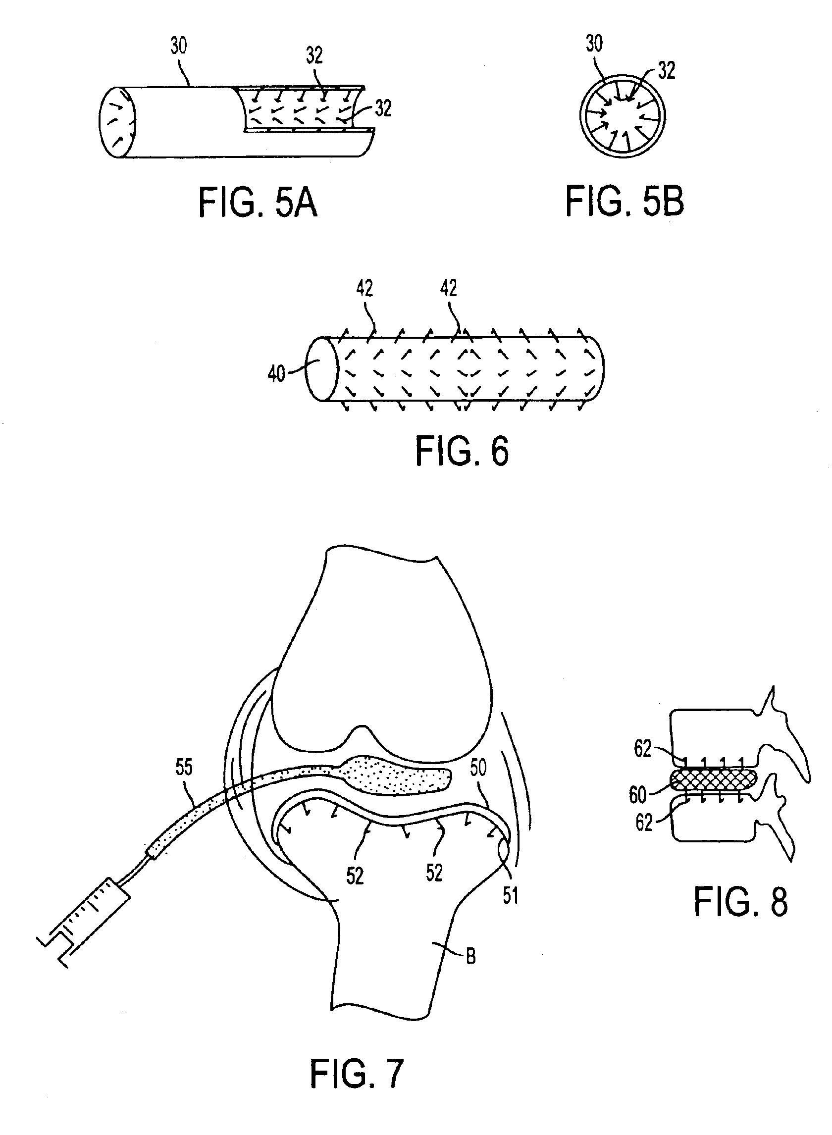 Multi-barbed device for retaining tissue in apposition and methods of use