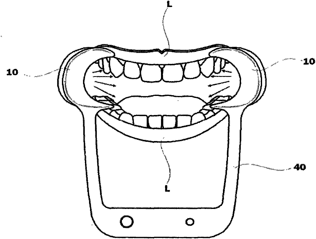 Intraoral LED illumination device with biteblock