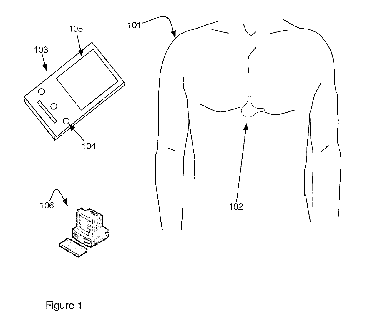 Electrocardiogram device and methods