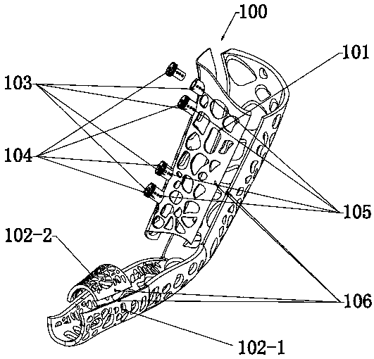 An intelligent personalized exoskeleton device for fracture treatment