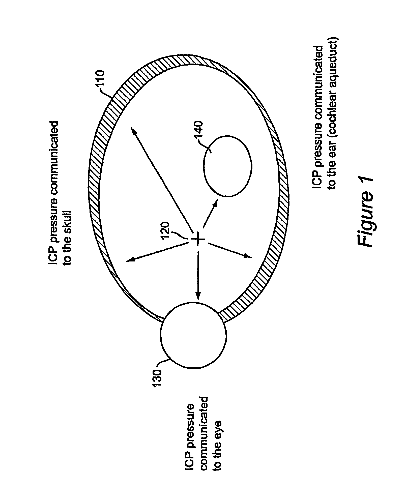 Method and apparatus for monitoring intra ocular and intra cranial pressure