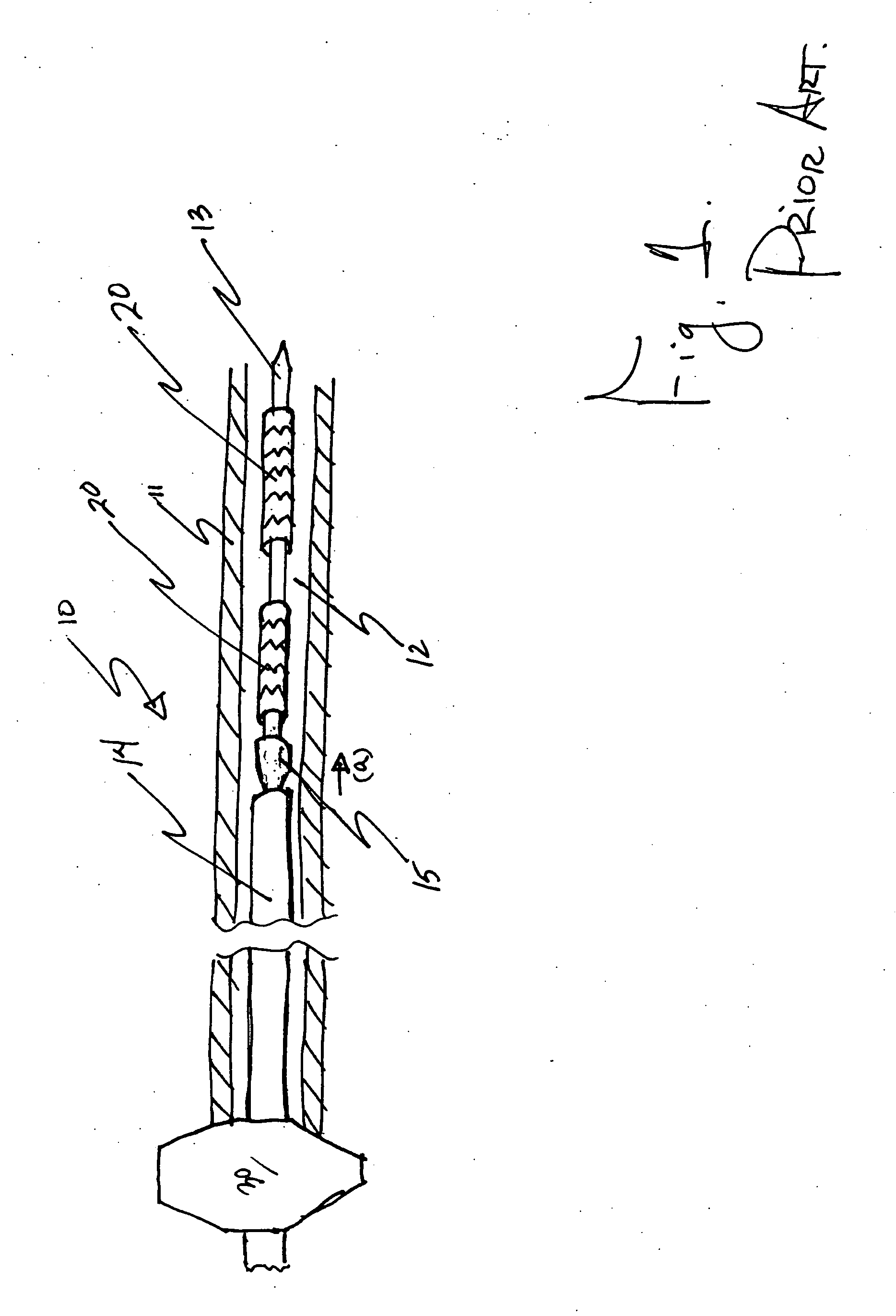 Stent delivery system with improved delivery force distribution