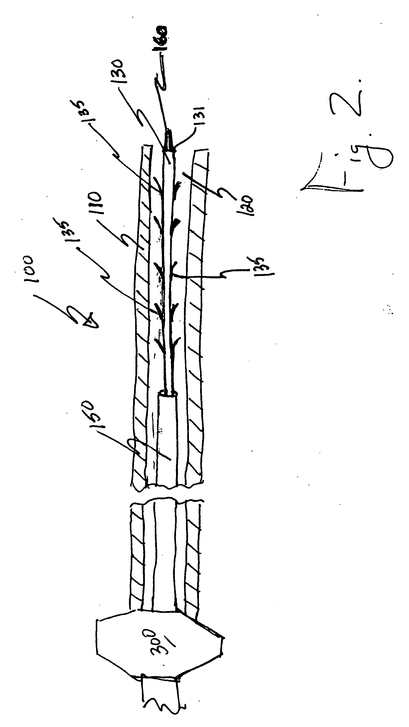 Stent delivery system with improved delivery force distribution