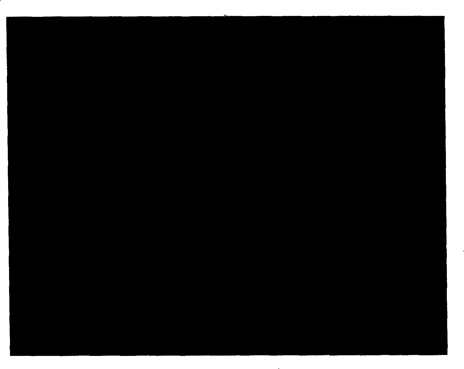 Lysine-chitosan resin and preparation method thereof