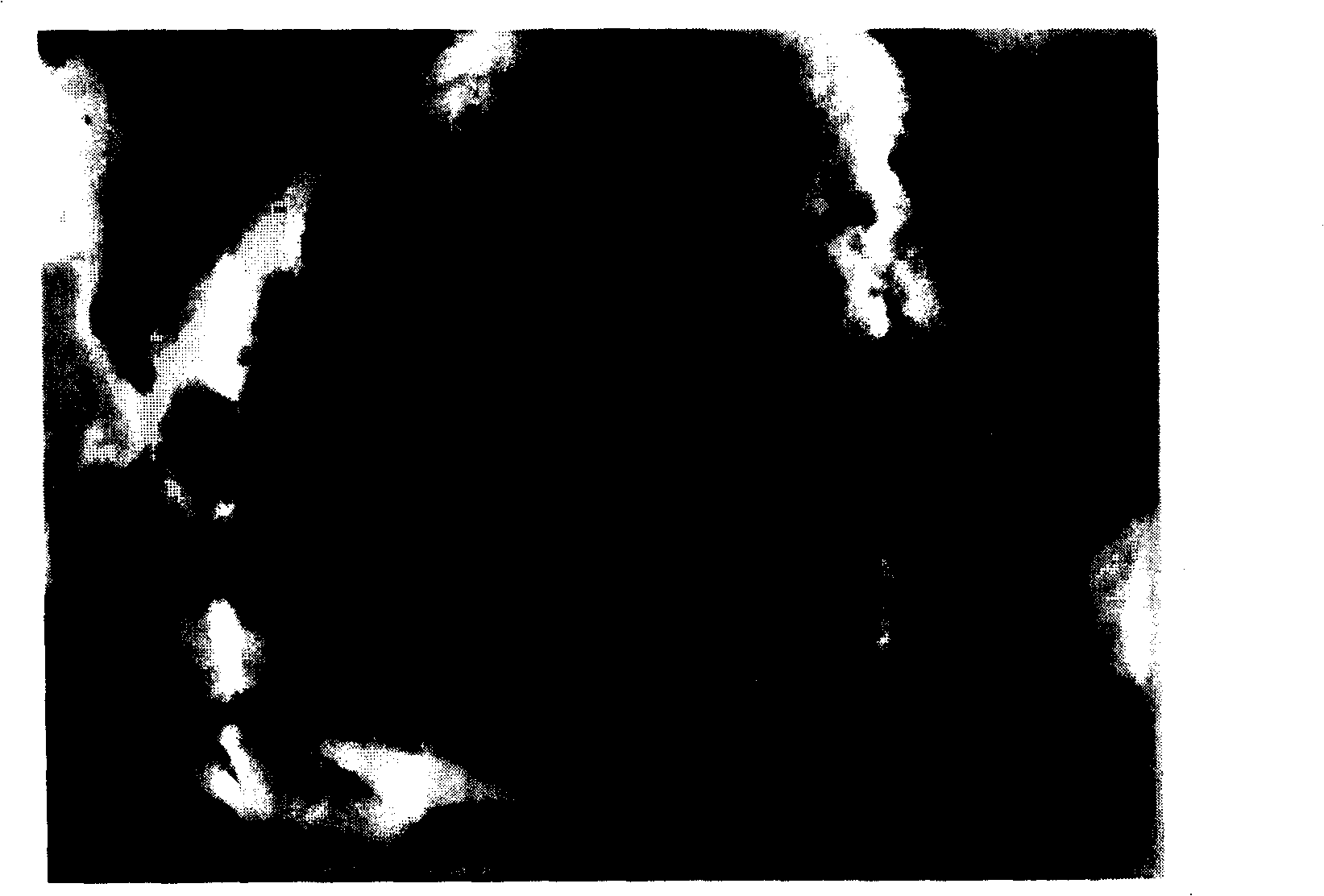 Lysine-chitosan resin and preparation method thereof