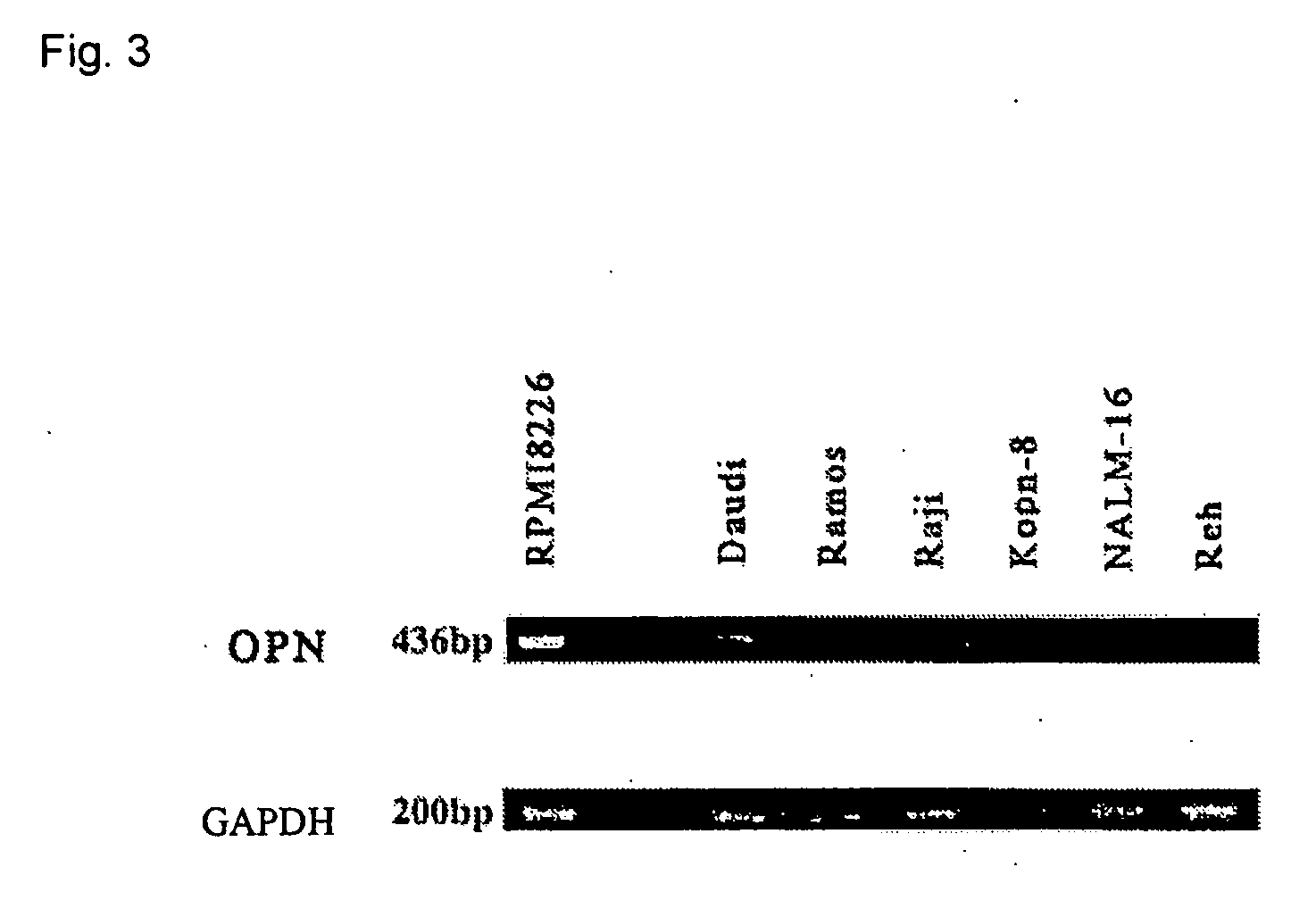 Method of inhibiting production of osteopontin