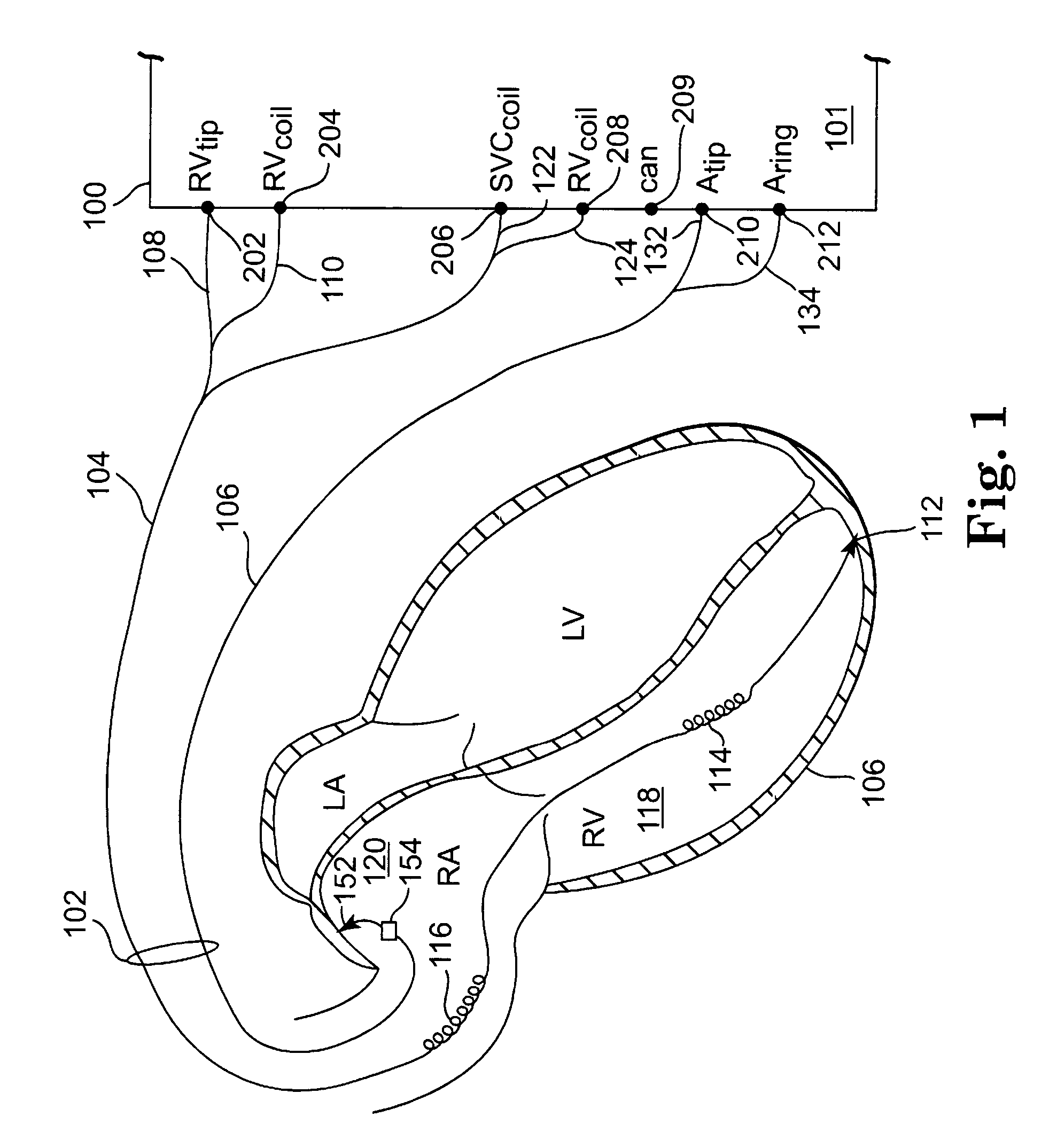 Cardiac rhythm template generation system and method