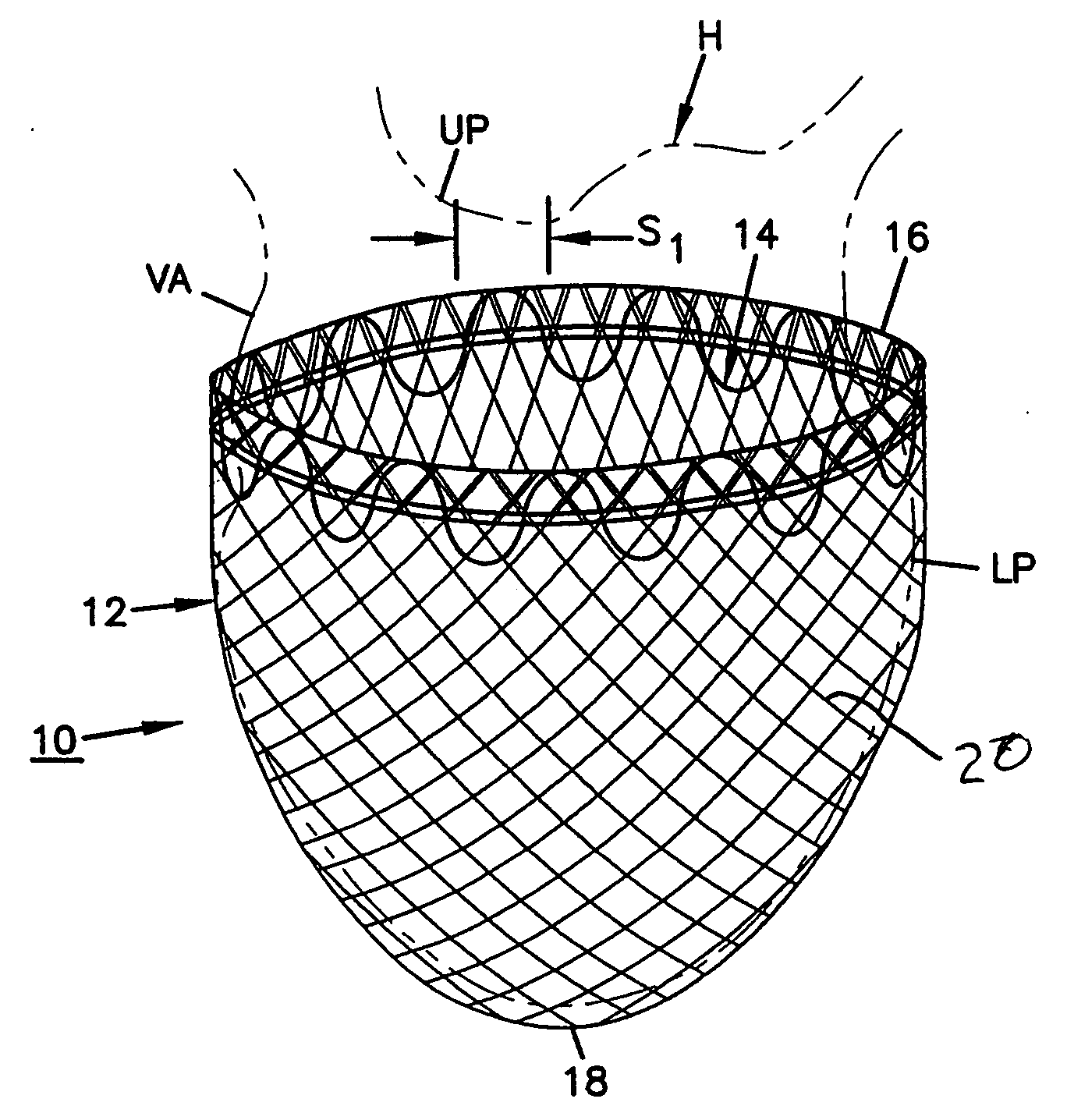 Self-adjusting attachment structure for a cardiac support device