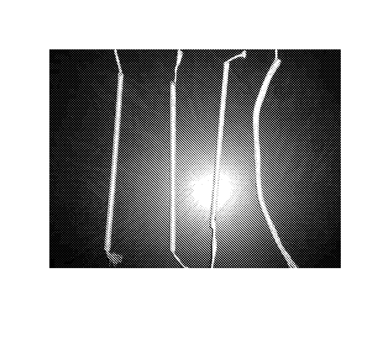 High-strength biological scaffold material and preparation method thereof