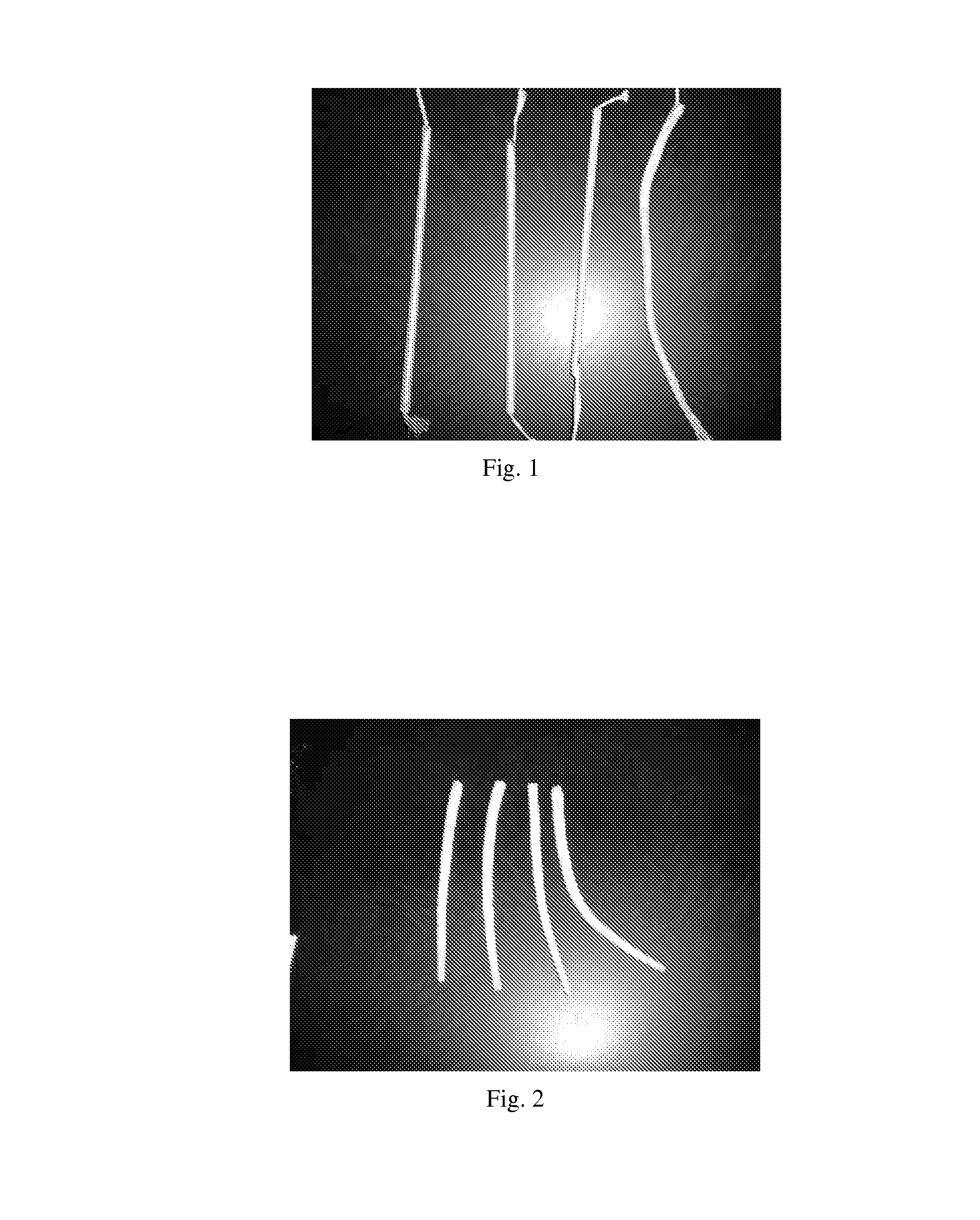 High-strength biological scaffold material and preparation method thereof