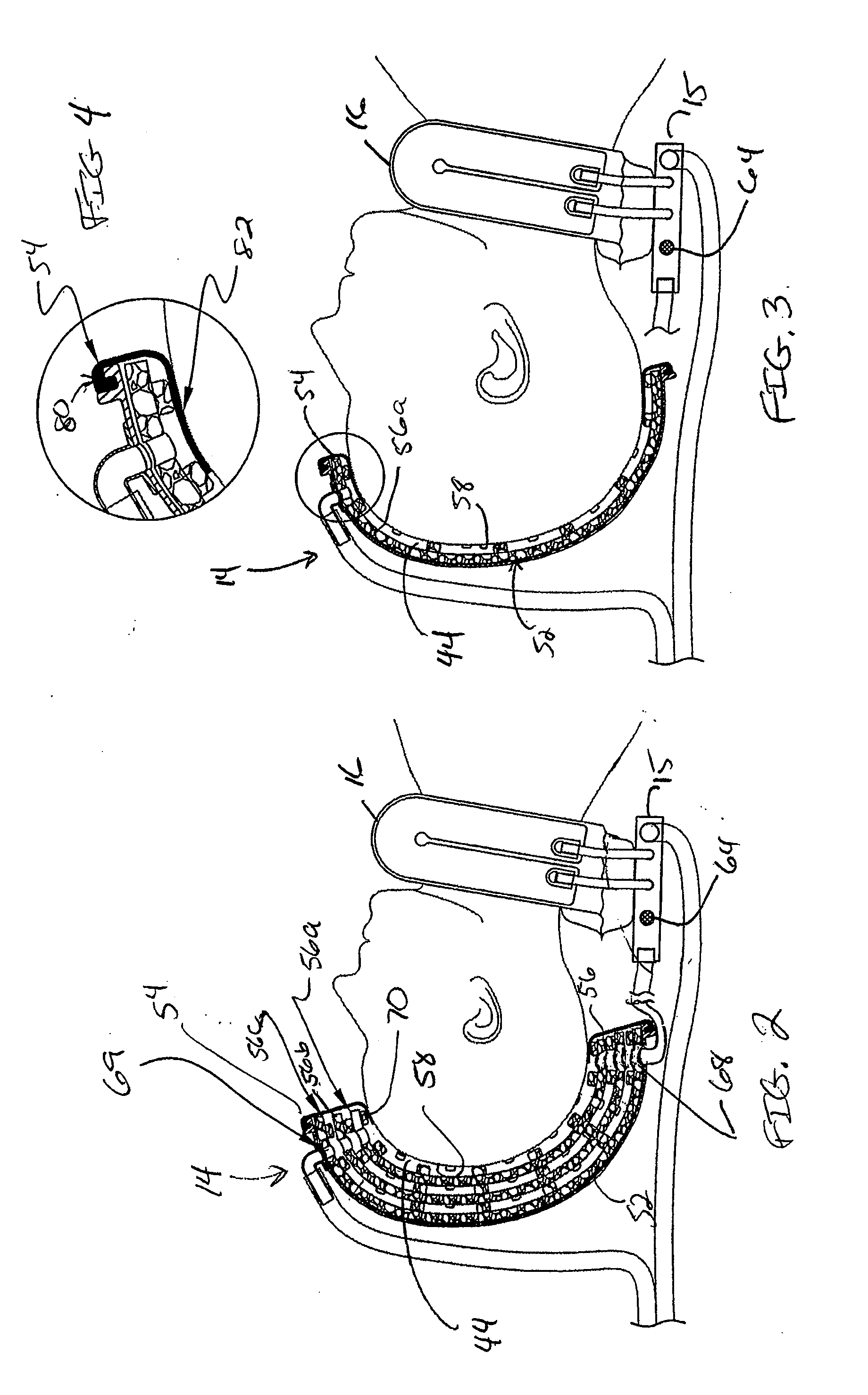 Adjustable thermal cap