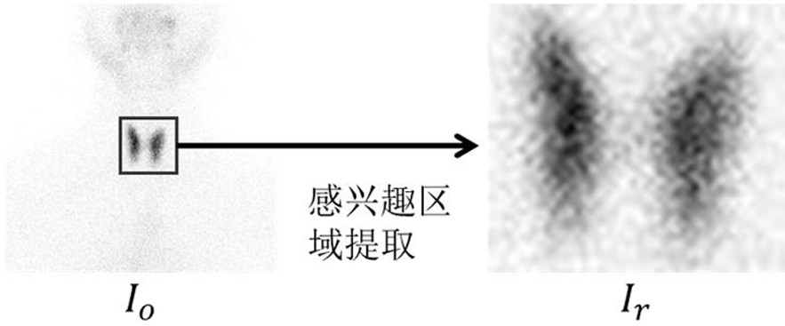 SPECT thyroid imaging intelligent recognition method based on deep neural network