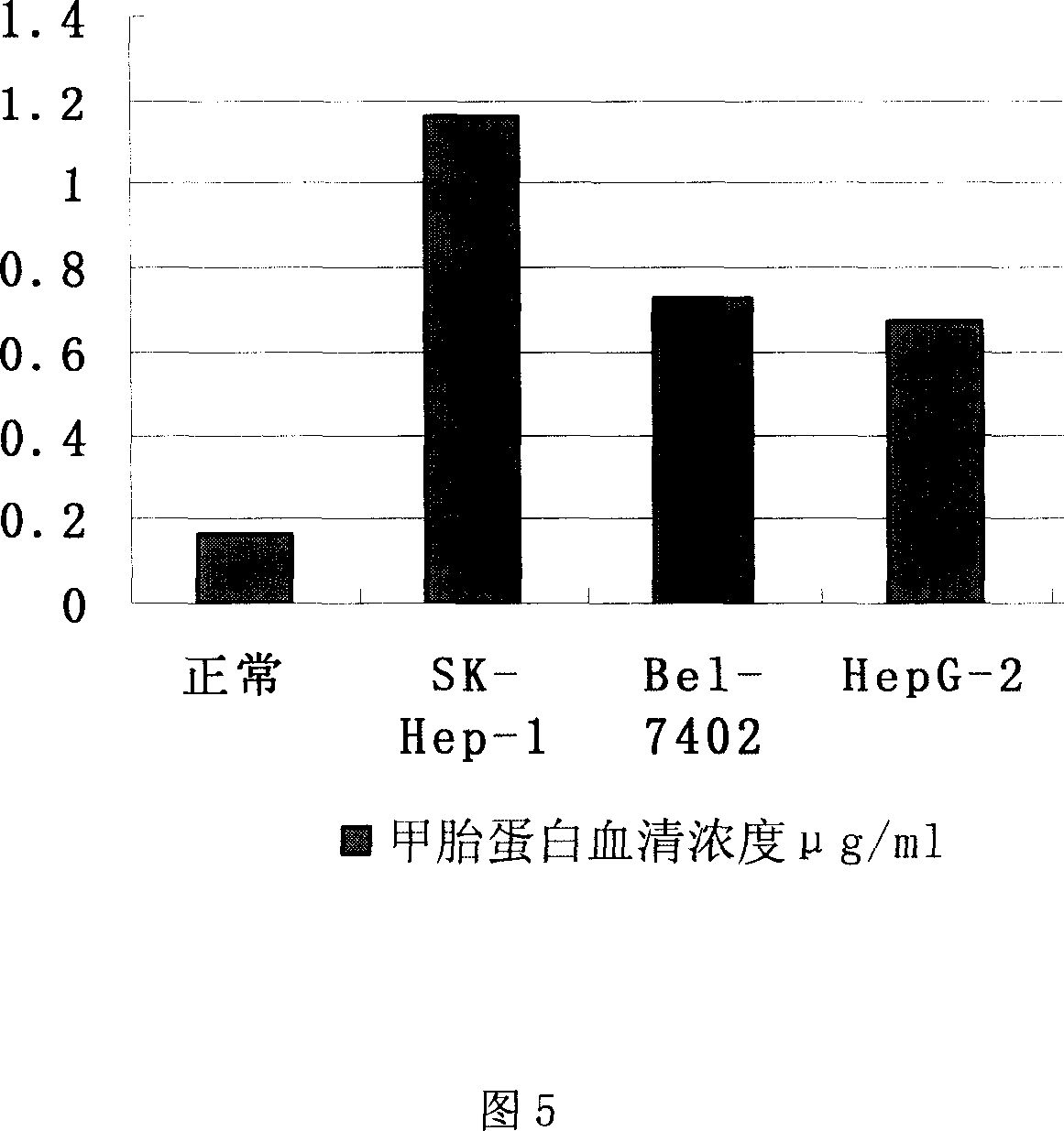 In-situ transplantation process of constructing human liver cancer mouse model