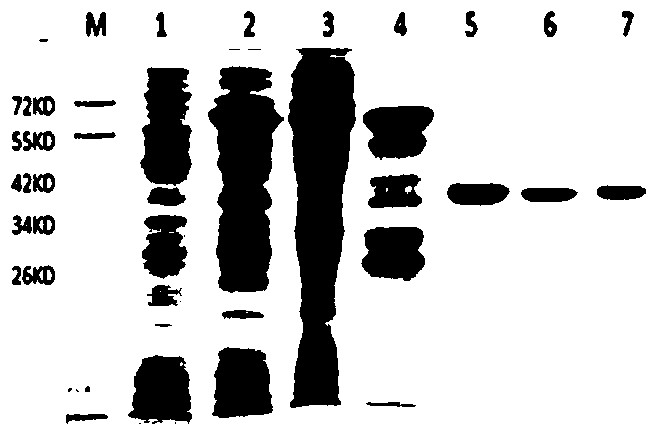 rgd-recombinant staphylokinase-human alpha microglobulin fusion protein and its preparation and application