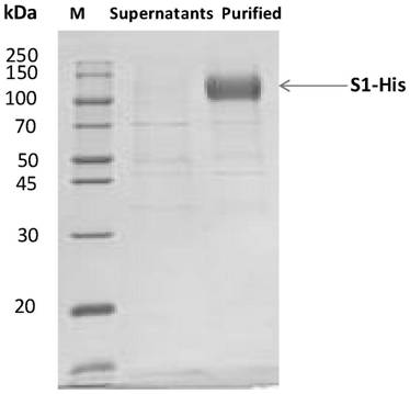 SARS-CoV-2 S protein specific antibody or fragment thereof and application thereof