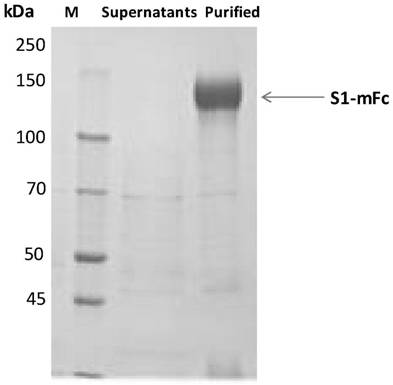 SARS-CoV-2 S protein specific antibody or fragment thereof and application thereof