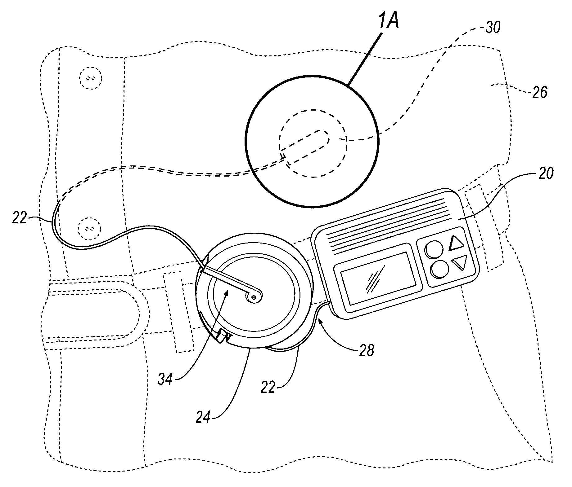 Retractable reel