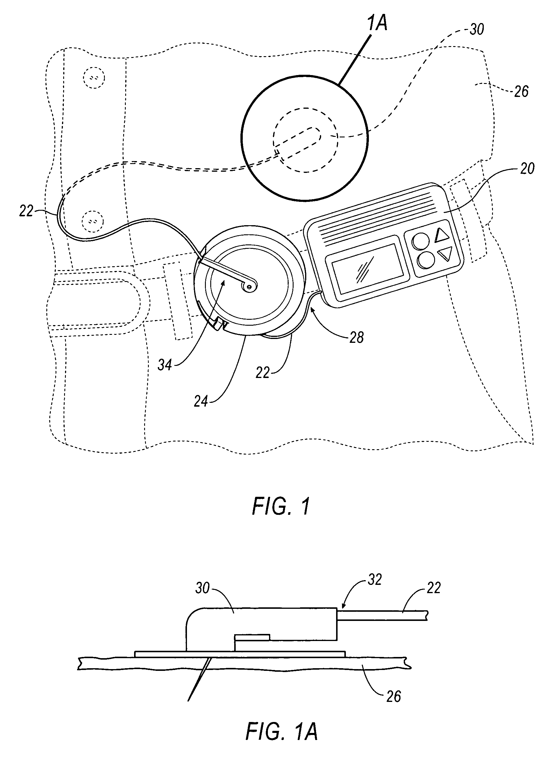 Retractable reel