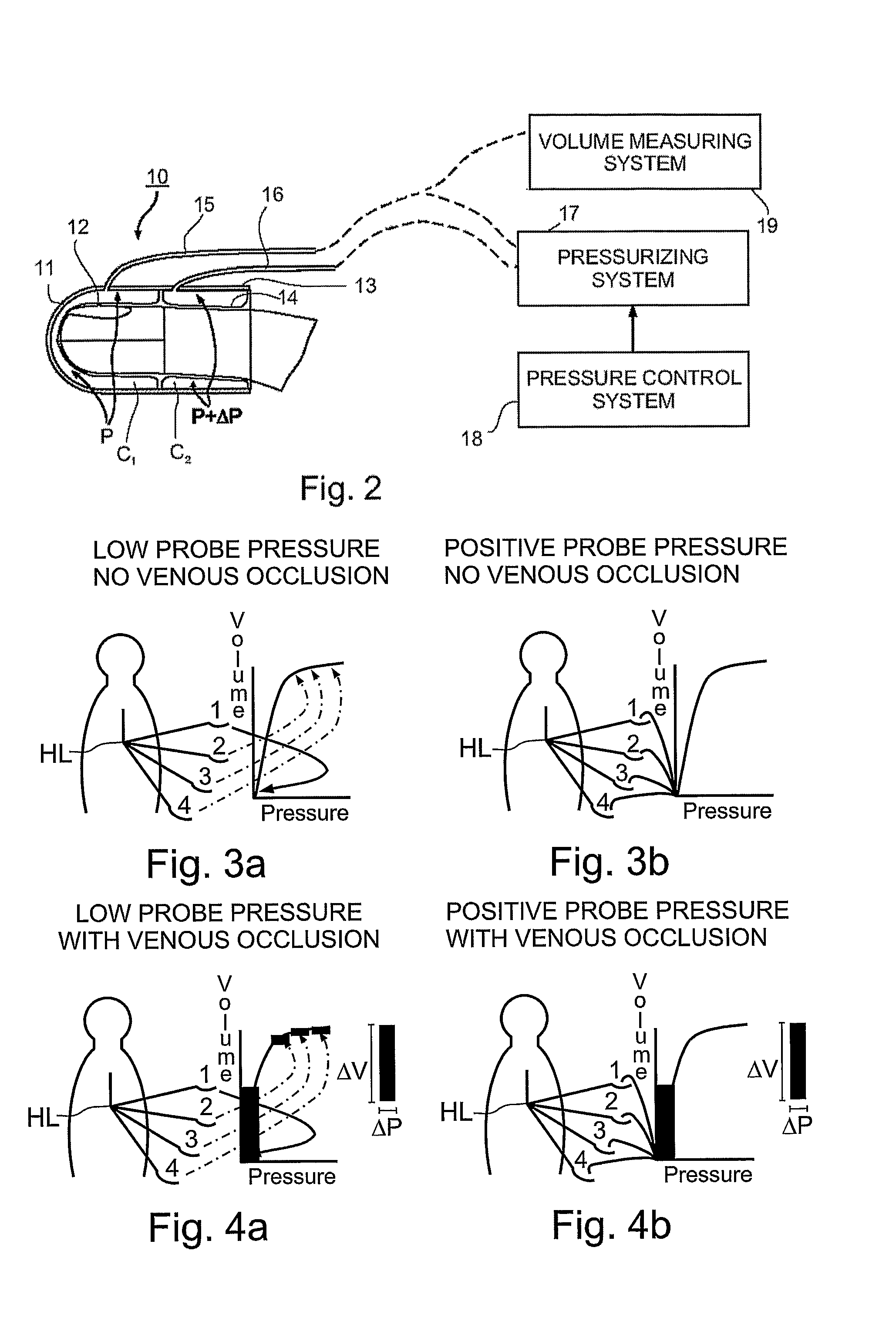 Measuring Blood Flow and Venous Capacitance