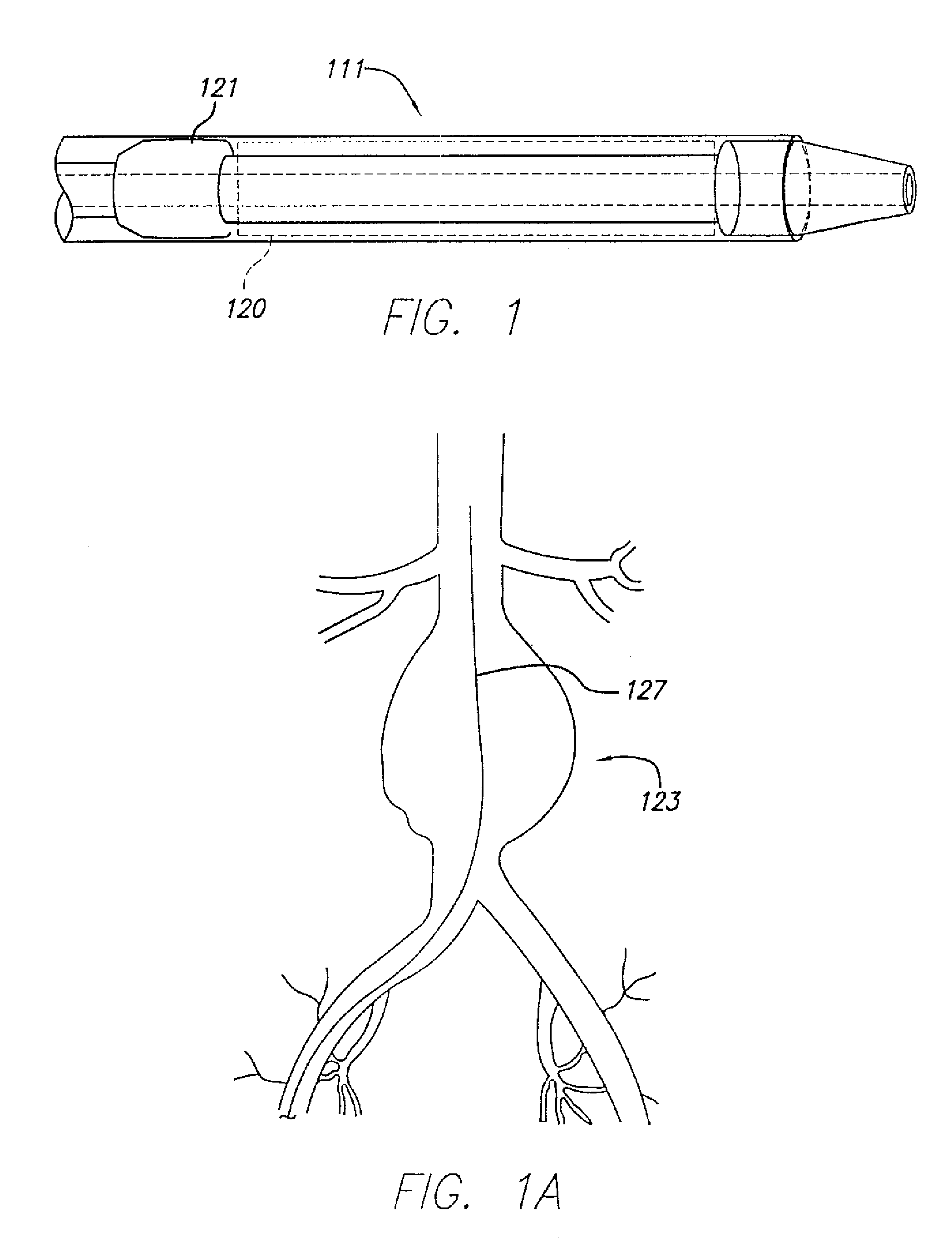 Staged endovascular graft delivery system