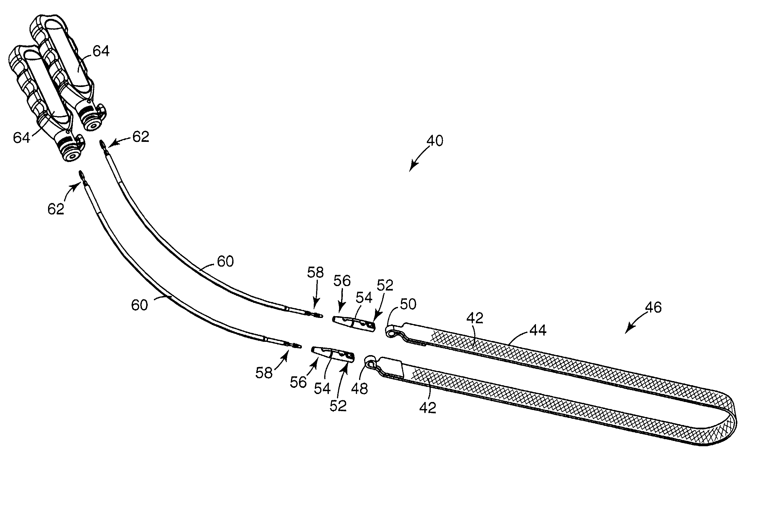 Implantable article and method