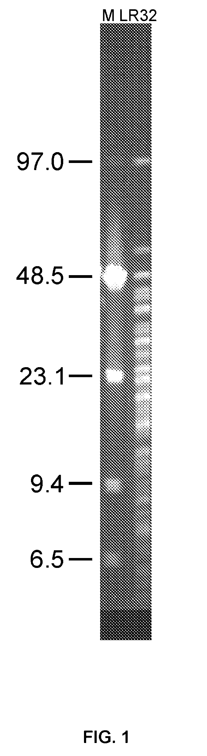 Probiotic Strain of Lactobacillus Reuteri Exhibiting Anti-Helicobacter Activity, a Probiotic or Biotherapeutic Product Comprising Said Strain, and the Use Thereof