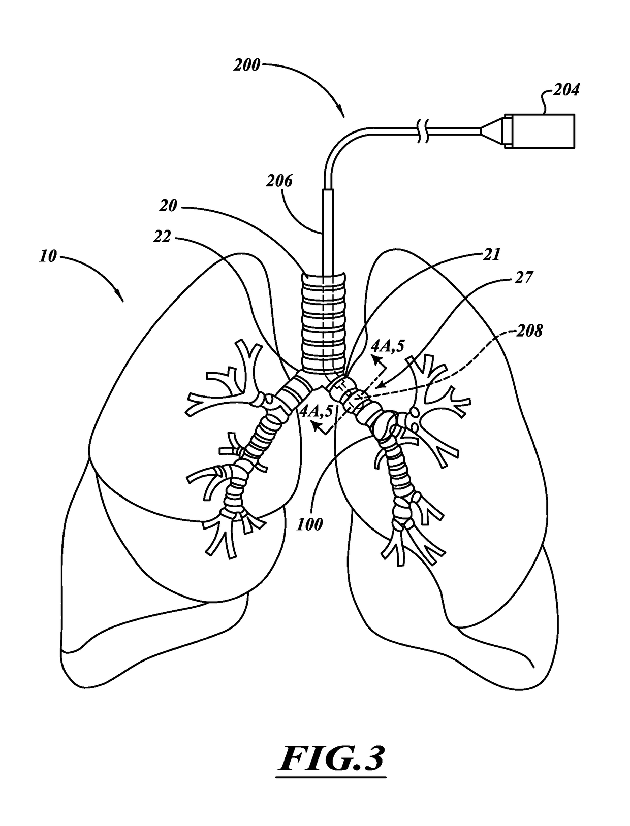 Apparatus for injuring nerve tissue