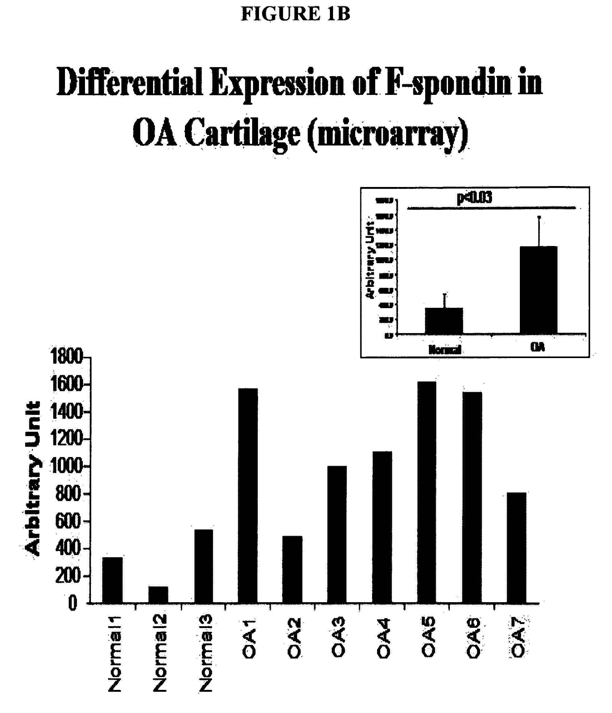 Methods of using F-spondin as a biomarker for cartilage degenerative conditions and bone diseases