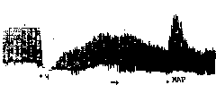 Anti-opioid peptide antagonist peptide and application thereof