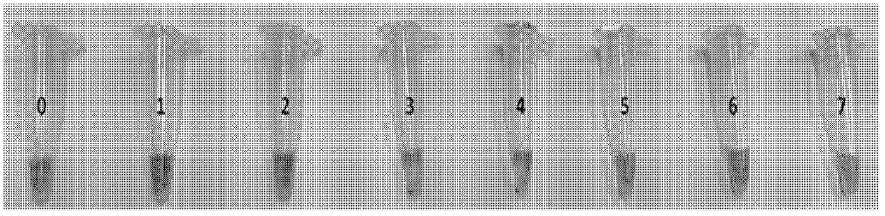 Loop-mediated isotherm amplification (LAMP) kit for detecting mycoplasma pneumoniae (Mp)