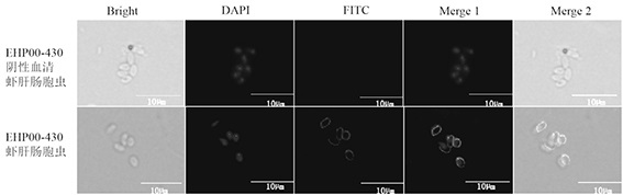 Enterocytozoon hepatopenaei spore wall protein as well as preparation and application of polyclonal antibody thereof