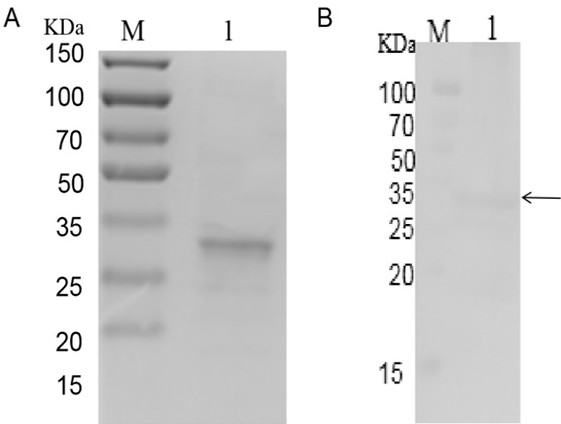 Enterocytozoon hepatopenaei spore wall protein as well as preparation and application of polyclonal antibody thereof