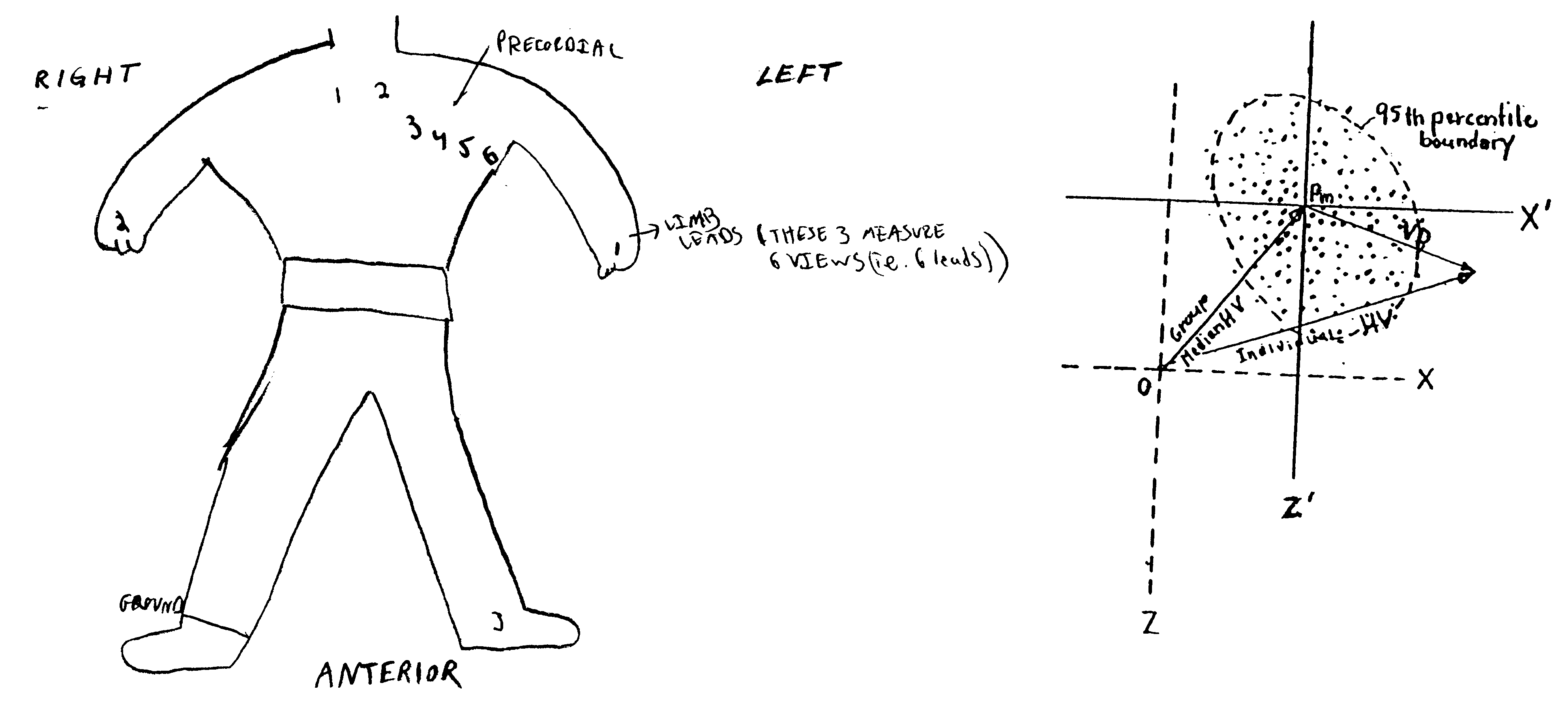 Method of analysis of the electrocardiogram