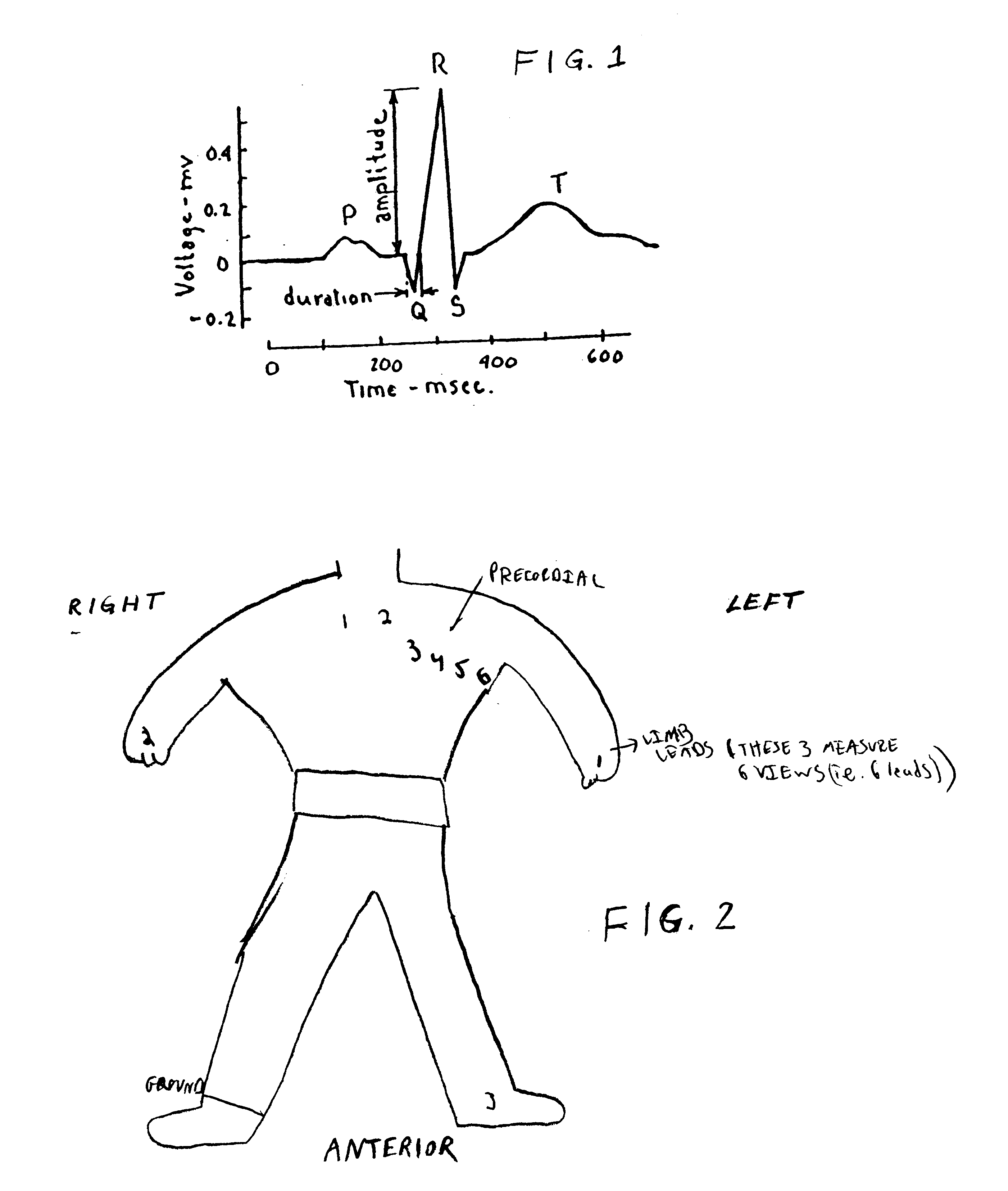 Method of analysis of the electrocardiogram