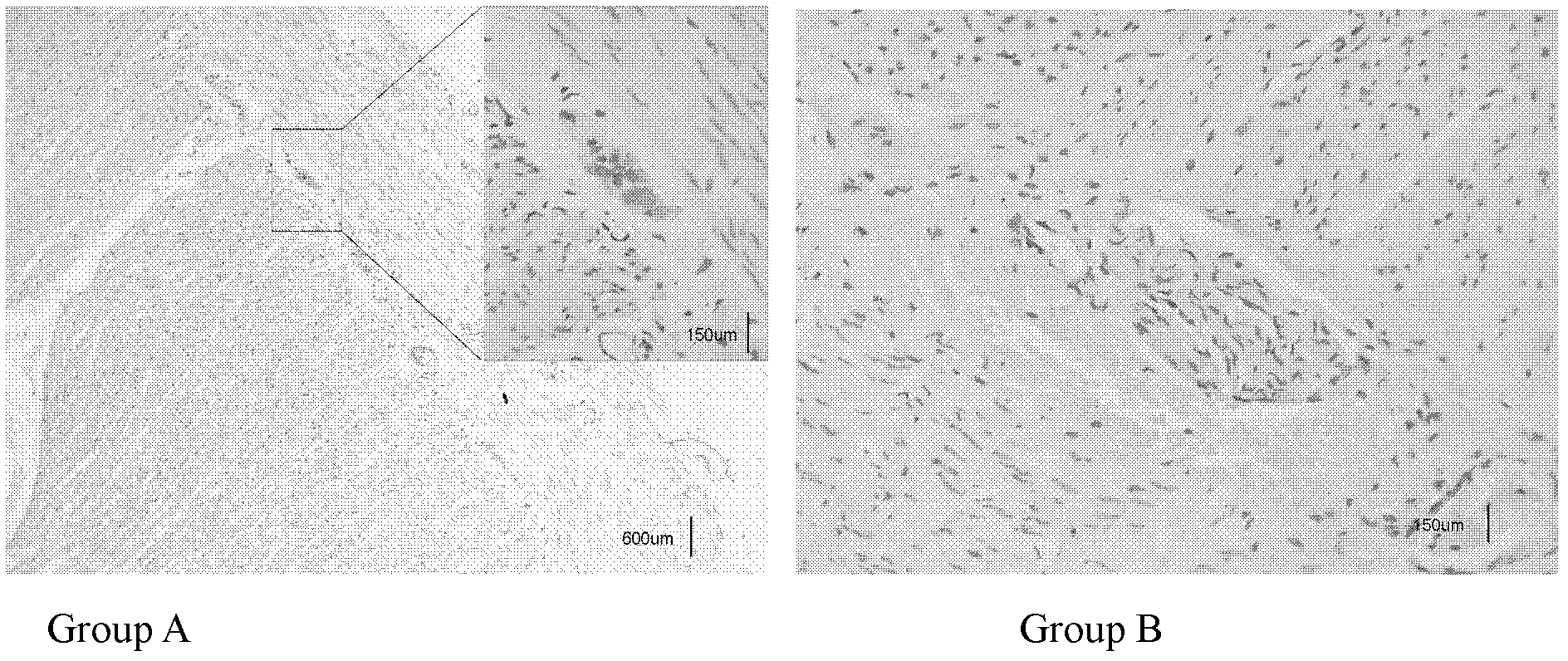 Plasma micro-ribonucleic acid (miRNA) marker related with human Hirschsprung's disease and application of miRNA marker