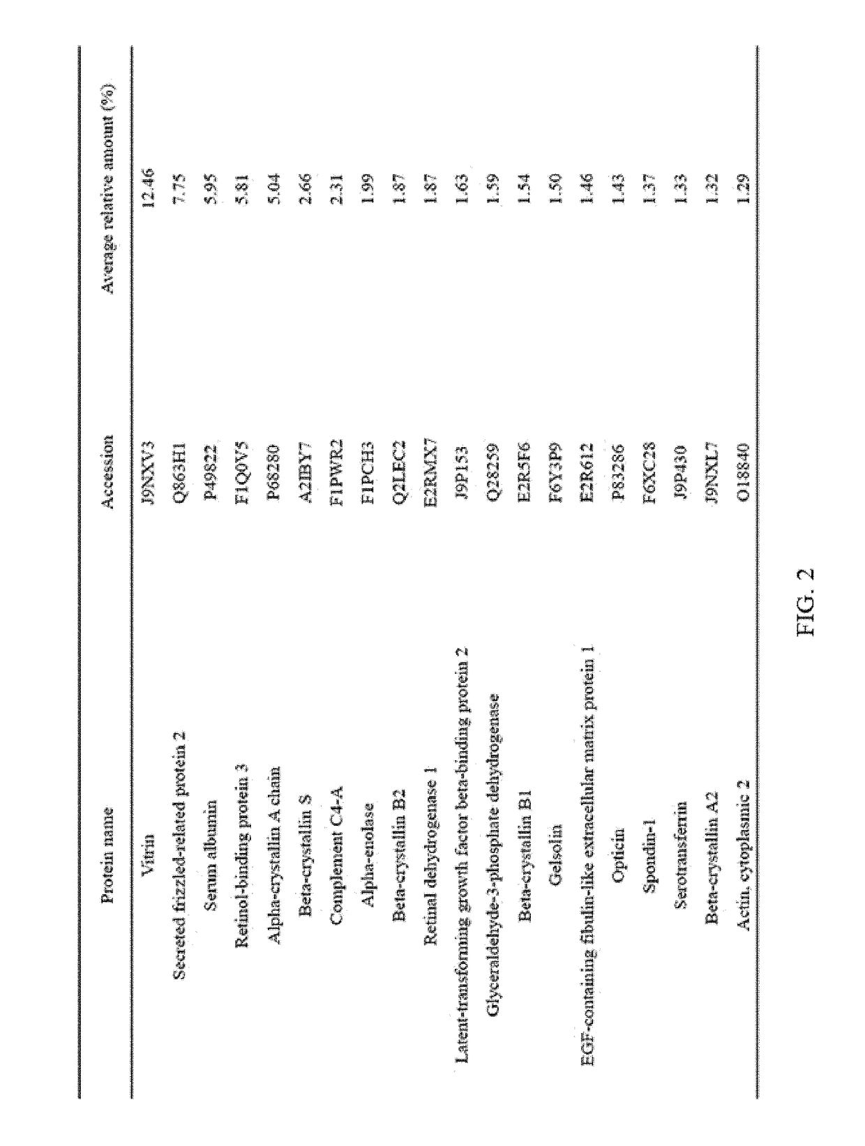 Composition for inhibiting angiogenesis comprising nanoparticle-vitreous body-based protein complex as active ingredient, and use thereof