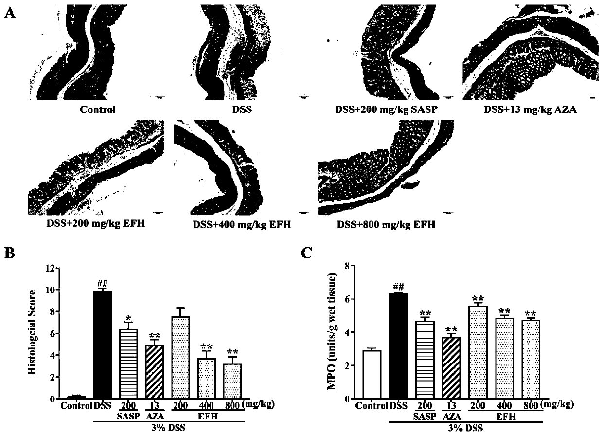 Application of silver leaf tree fruit in preparing drug for treating ulcerative colitis