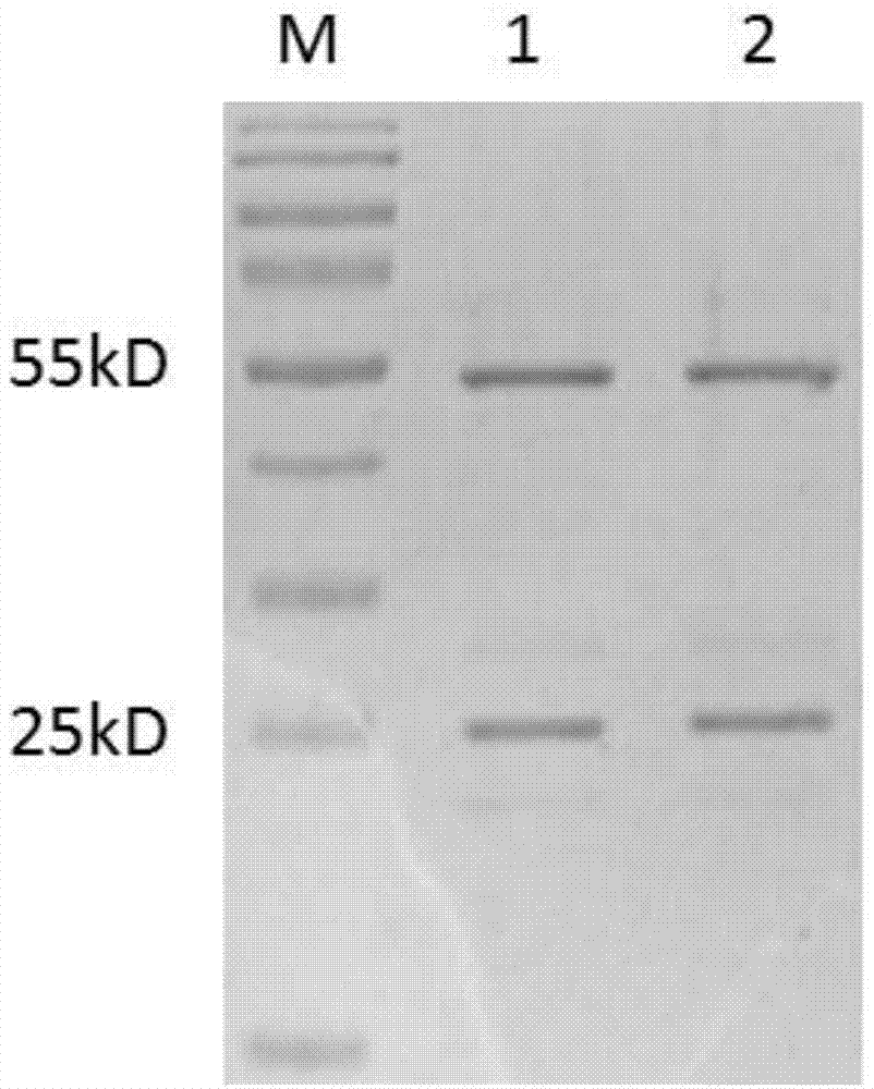 Toxoplasma gondii TgVP1 extracellular region antigen polypeptide, anti-toxoplasma gondii TgVP1 polyclonal antibody and application of polyclonal antibody