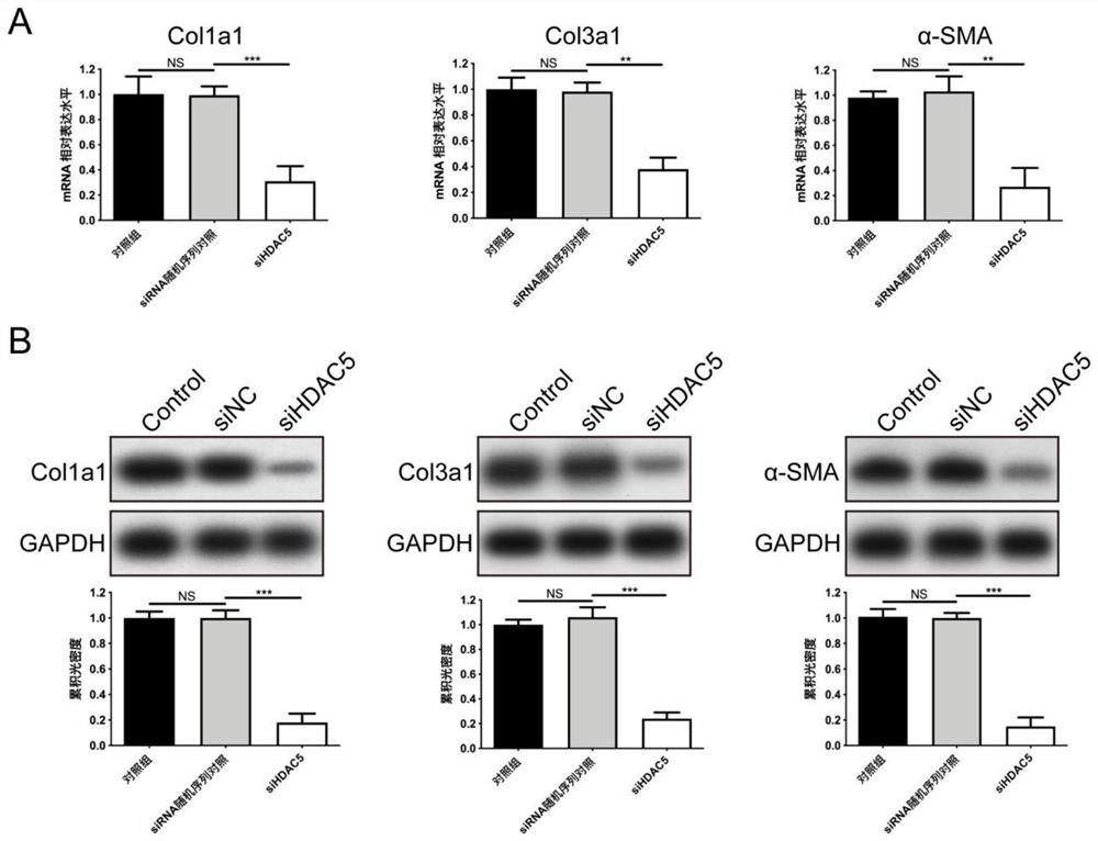 Use of the siRNA molecular composition in the preparation of medicines targeting hdac5 to inhibit scar formation