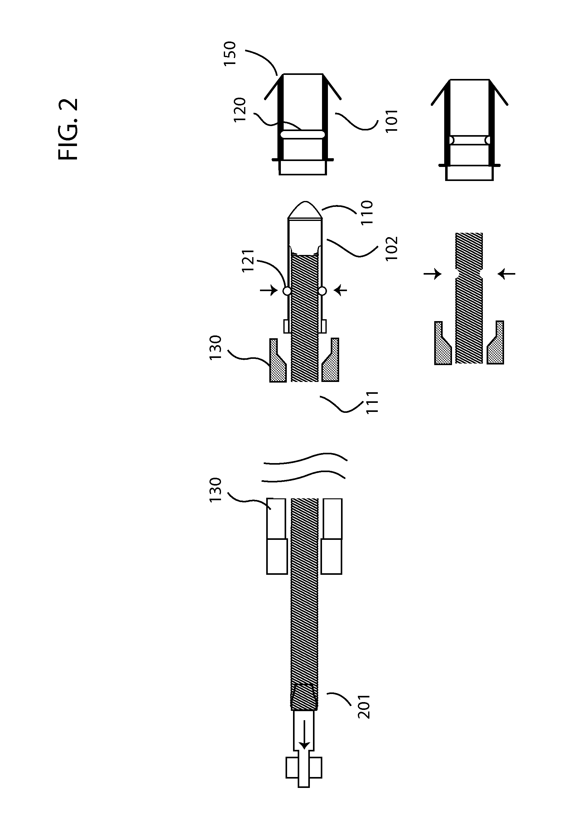 Detachable electrode and anchor