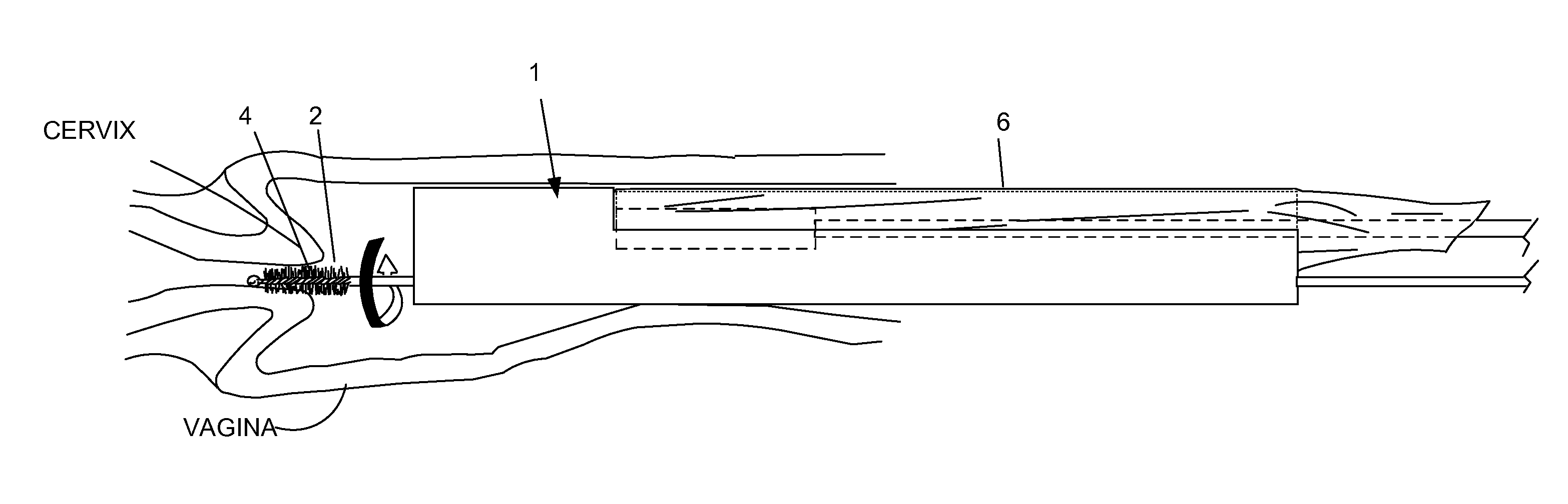 Device and method for conducting a pap smear test