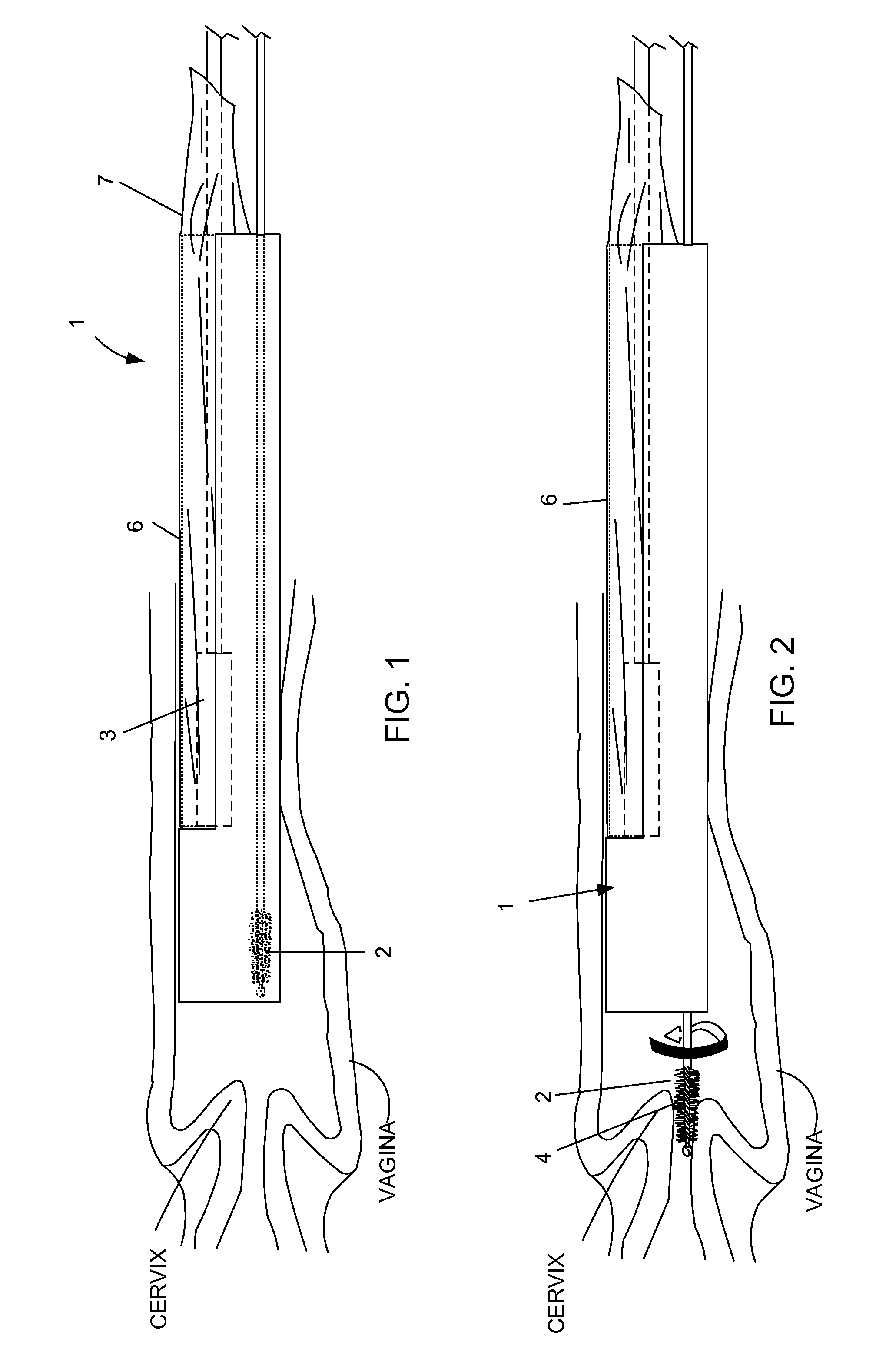 Device and method for conducting a pap smear test