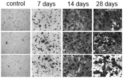 Composition for inhibiting calcification of endothelial progenitor cells and detection kit