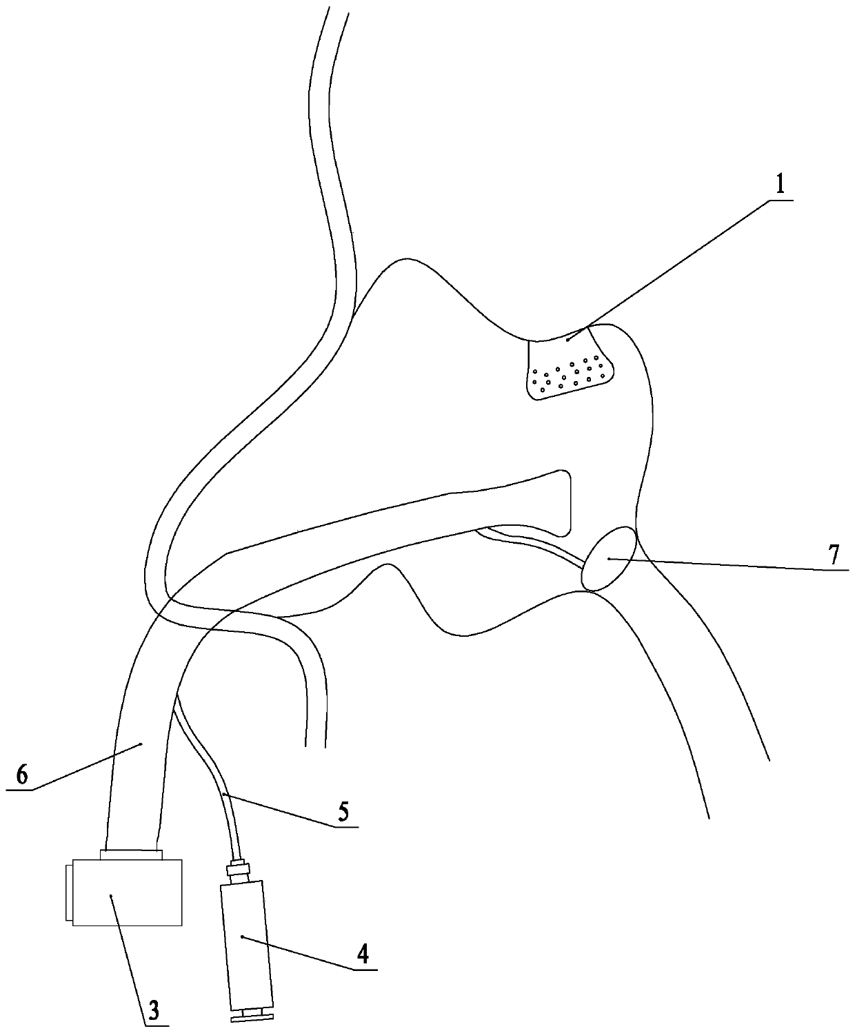 Nasal irrigator