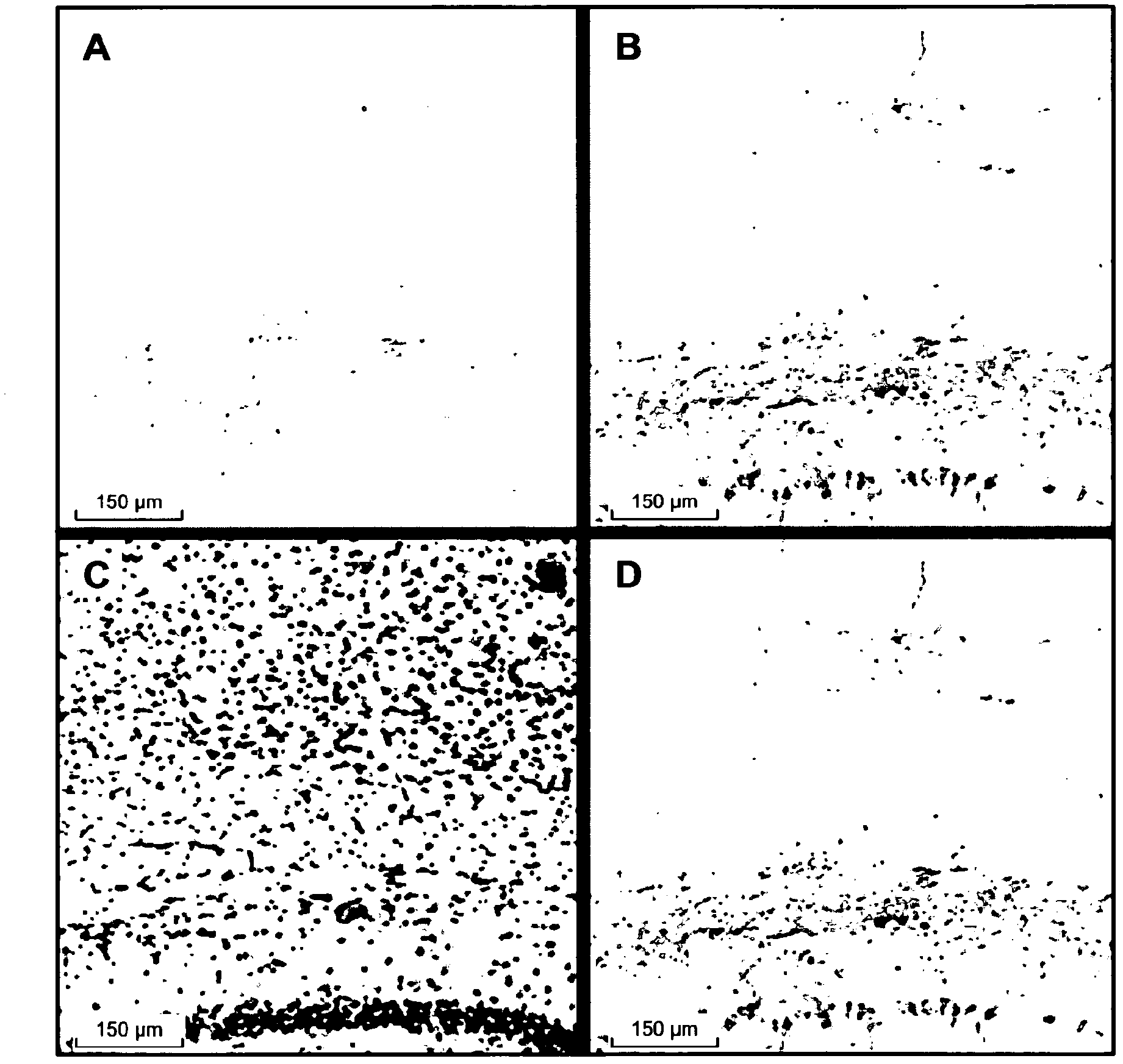 Use of an anti-tau ps422 antibody for the treatment of brain diseases