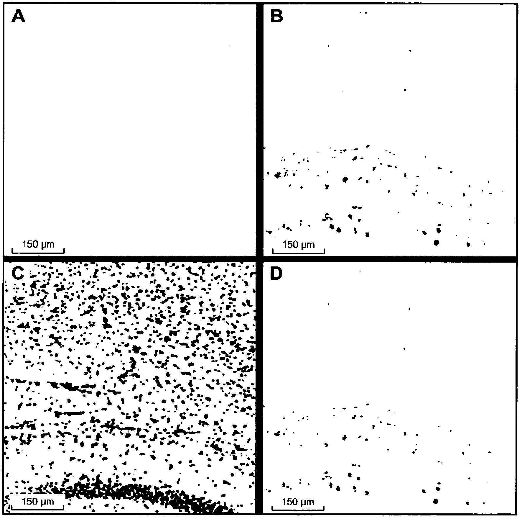 Use of an anti-tau ps422 antibody for the treatment of brain diseases